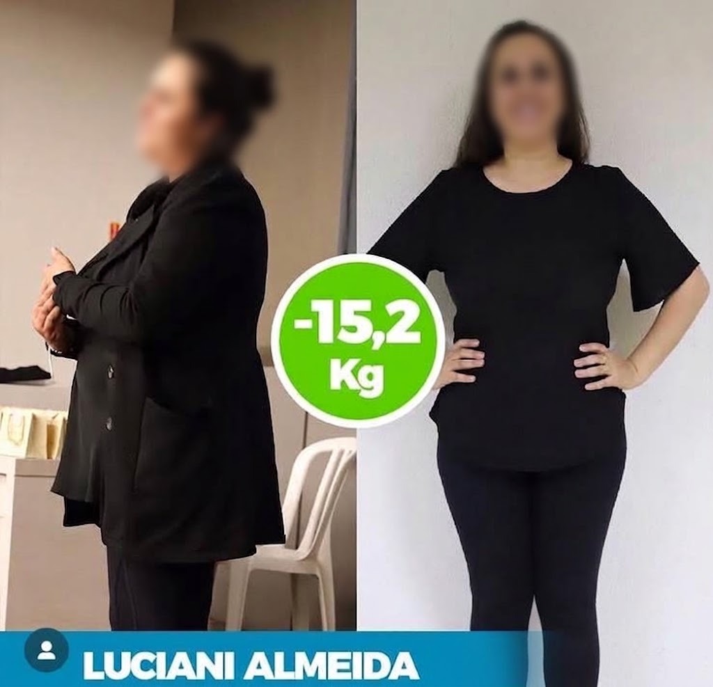 Luciani Almeida — antes e depois, −15,2 kg no protocolo